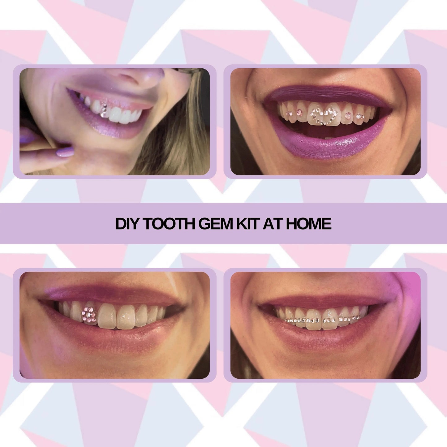 after tooth gem kit