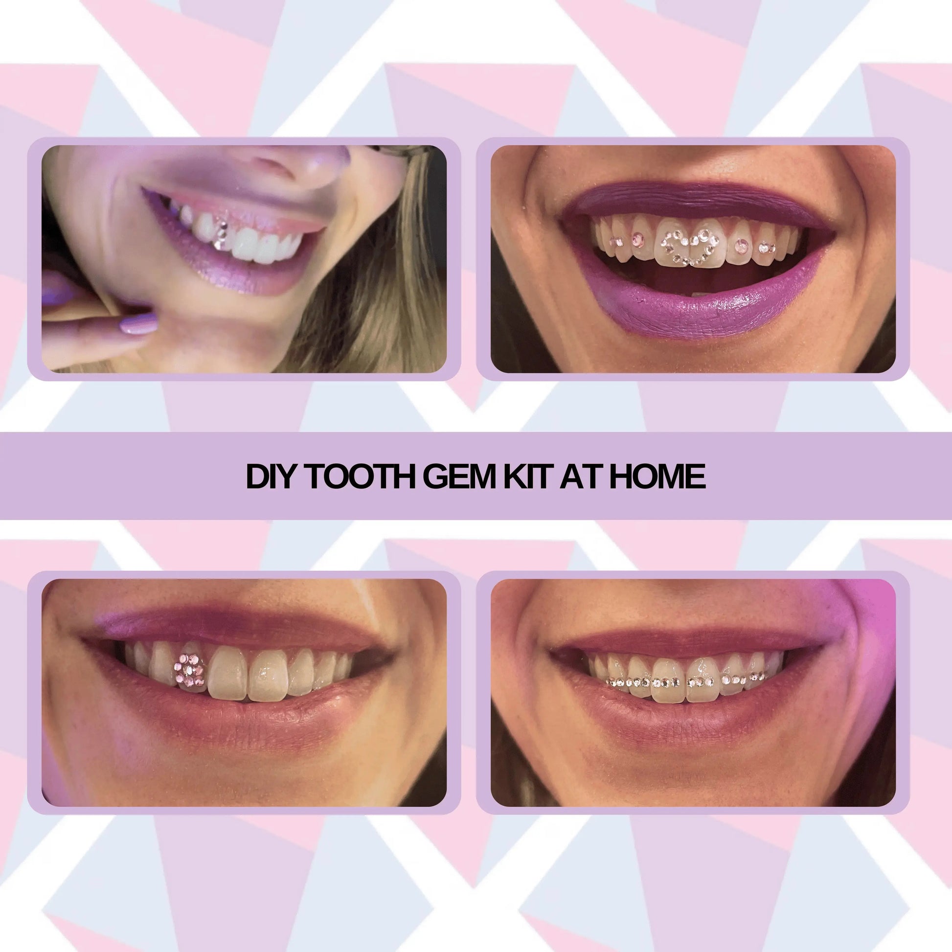 after tooth gem kit